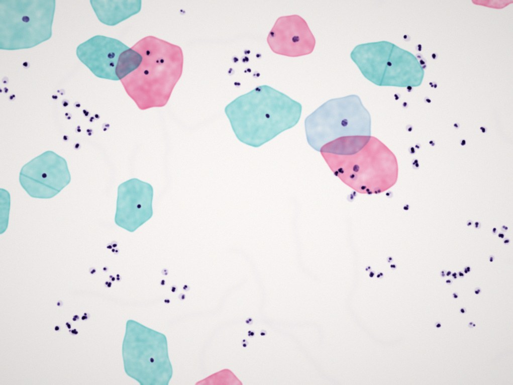 Illustration of a digitised Pap-stained slide for the selected case.